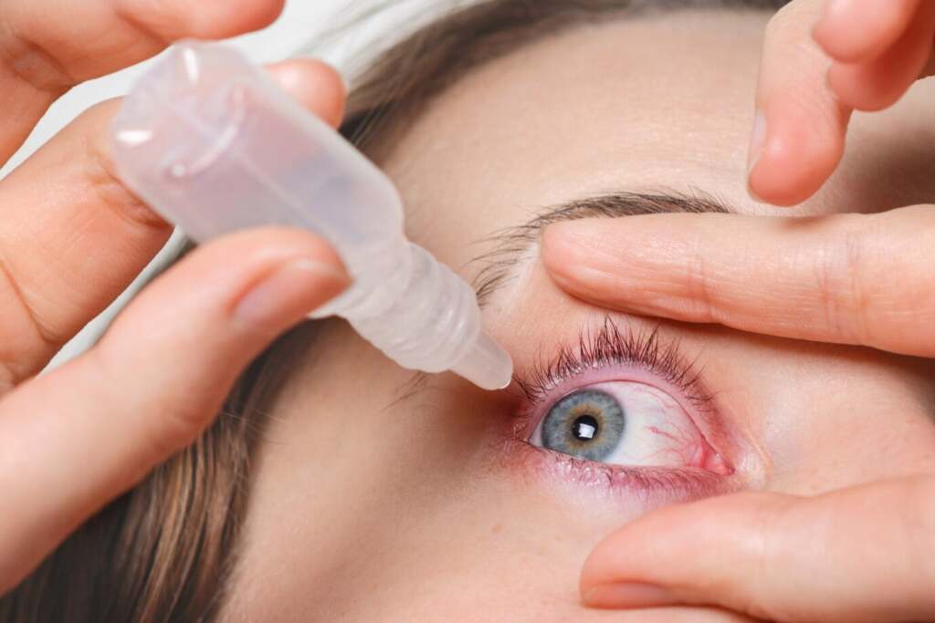 Bệnh về mắt: Hiểu để giữ gìn sức khỏe đôi mắt 33